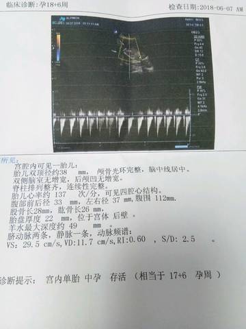 journal_insert_pic_1029405412
