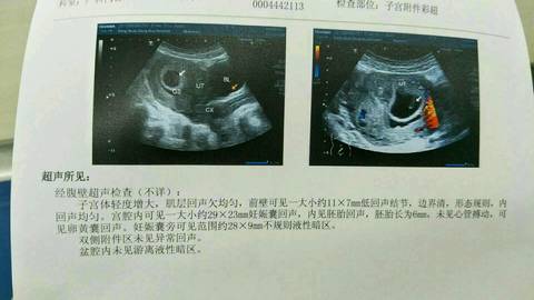 journal_insert_pic_1029627731