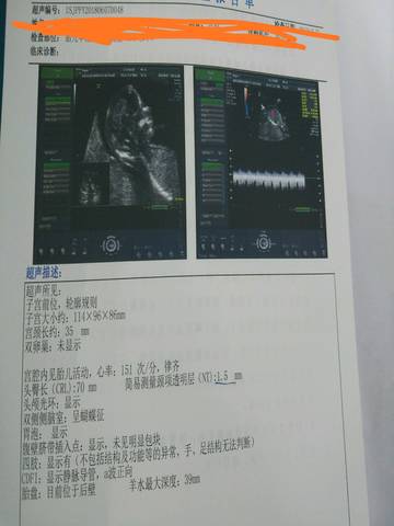 journal_insert_pic_1029536057