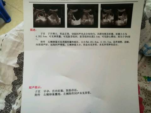 journal_insert_pic_1030173050