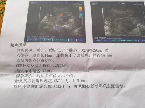 journal_insert_pic_1030057204