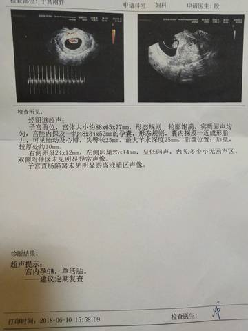 journal_insert_pic_1031811792