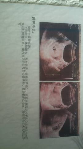 journal_insert_pic_1031778298