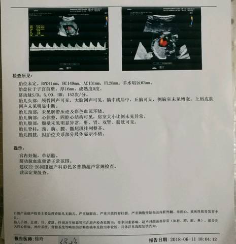 journal_insert_pic_1032700327