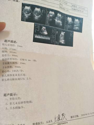 journal_insert_pic_1032996158