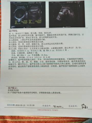 journal_insert_pic_1033818688