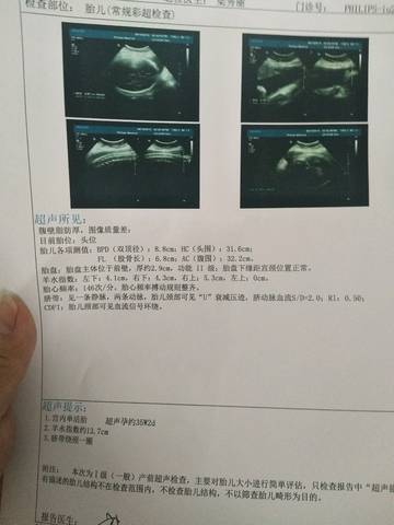 journal_insert_pic_1035355581