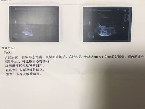 journal_insert_pic_1038150520