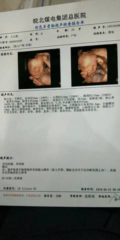 journal_insert_pic_1041010969