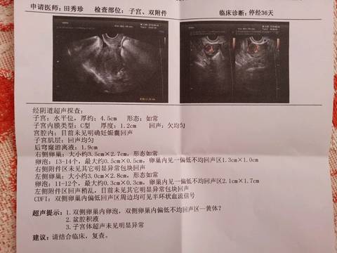 journal_insert_pic_1041164223