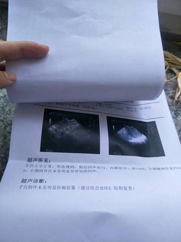 journal_insert_pic_1041810637