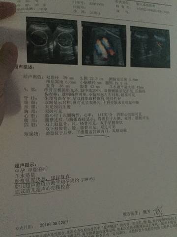 journal_insert_pic_1042917116