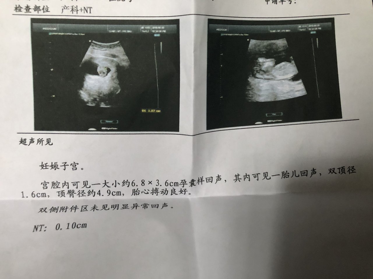 nt秒过