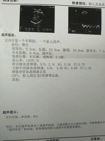 journal_insert_pic_1045880532