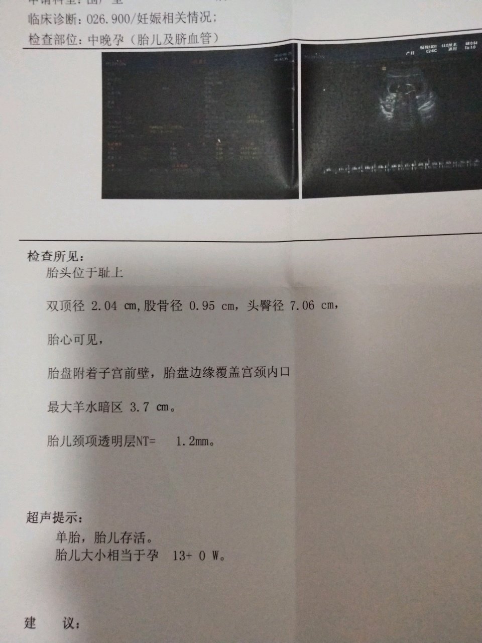 nt做了3次，结果总归是好的，看男女的我怎么没发现有什么依据