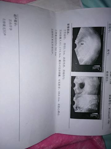 journal_insert_pic_1048423909