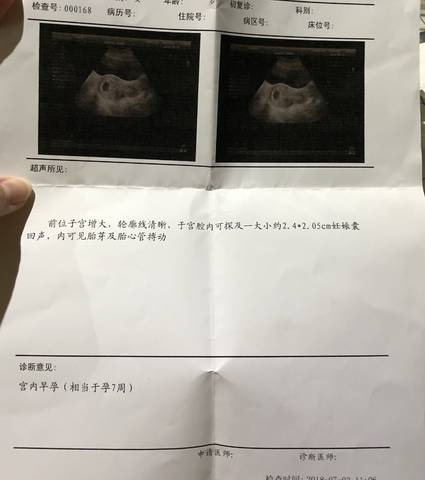 journal_insert_pic_1049392417