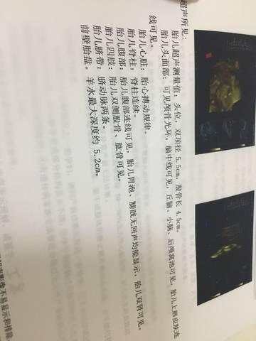 journal_insert_pic_1049720785