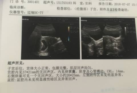 journal_insert_pic_1049806030