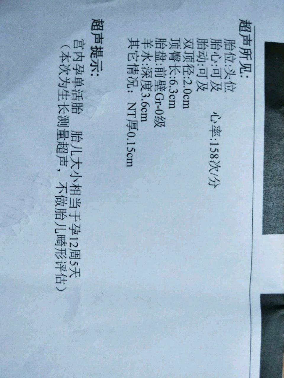 12周时做的NT，感觉照片好清晰
