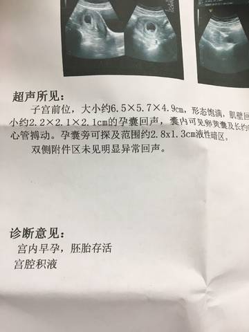 journal_insert_pic_1058588589