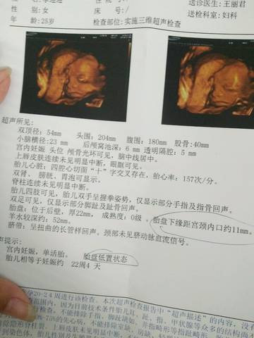 journal_insert_pic_1061525988