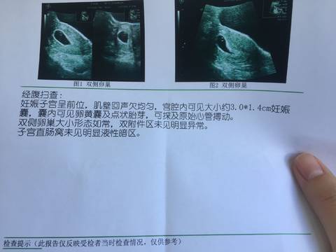 journal_insert_pic_1062558555