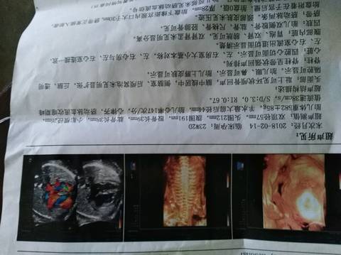 journal_insert_pic_1062558407