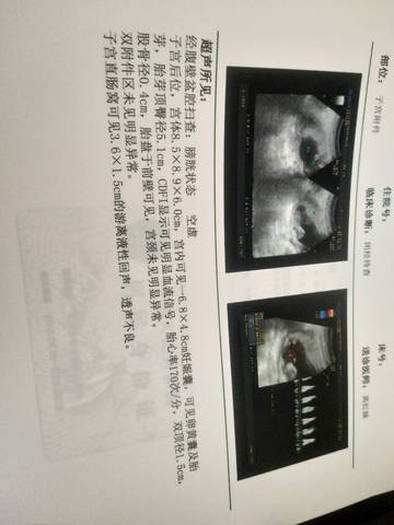journal_insert_pic_1062840416
