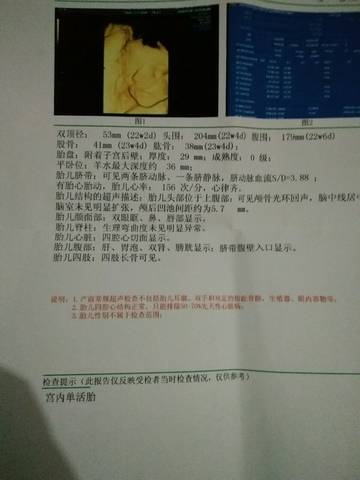 journal_insert_pic_1064628919