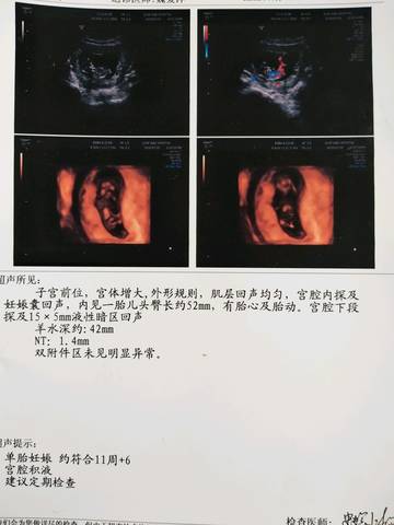 journal_insert_pic_1064261821