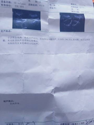 journal_insert_pic_1067111077