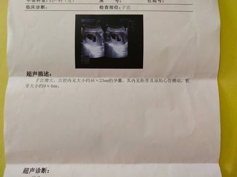 journal_insert_pic_1067506350