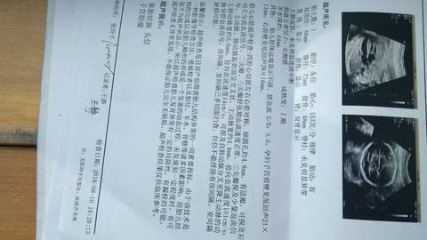 journal_insert_pic_1071824860