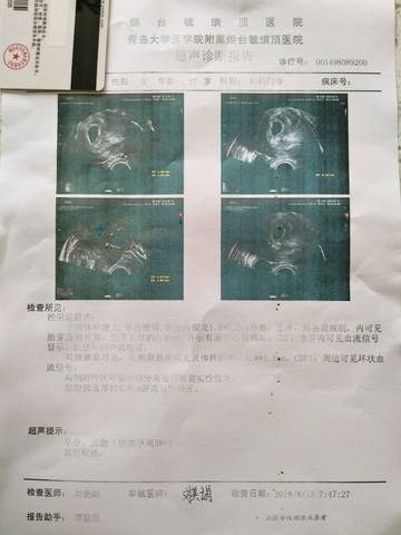 journal_insert_pic_1073116174