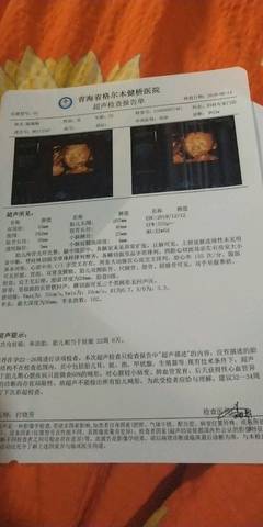 journal_insert_pic_1074063607