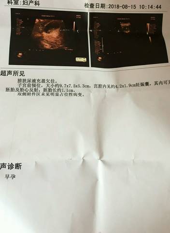 journal_insert_pic_1074701306