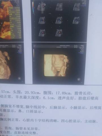 journal_insert_pic_1075256488