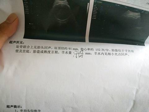 journal_insert_pic_1075612036
