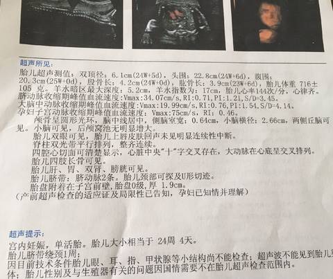 journal_insert_pic_1075613605