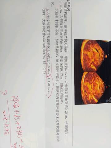 journal_insert_pic_1075598340