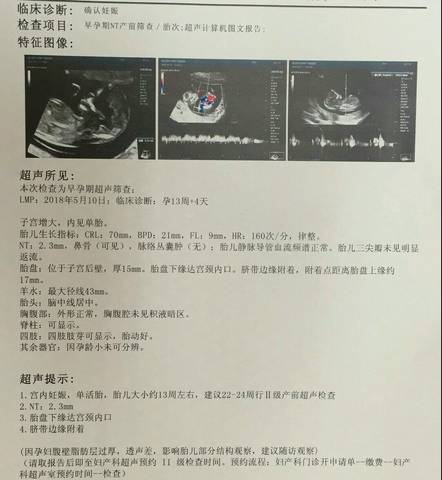 journal_insert_pic_1083544462