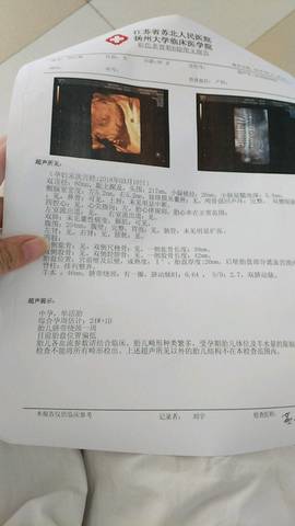 journal_insert_pic_1084384957