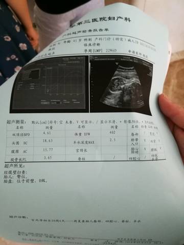 journal_insert_pic_1086128700