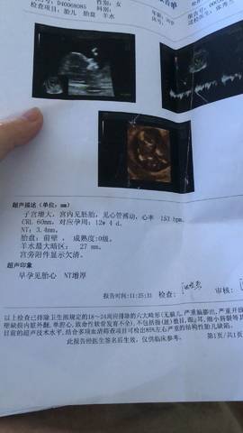journal_insert_pic_1087601758