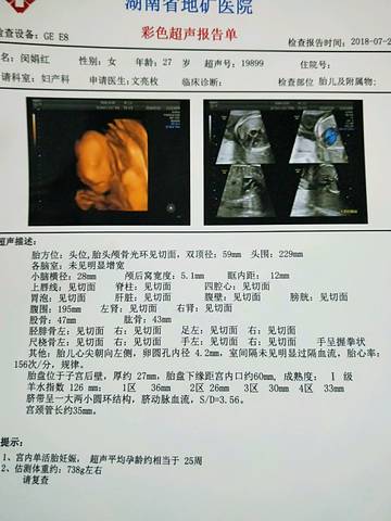 journal_insert_pic_1089780666