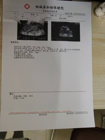 journal_insert_pic_1092347526