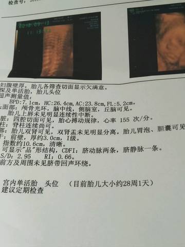 journal_insert_pic_1092777607