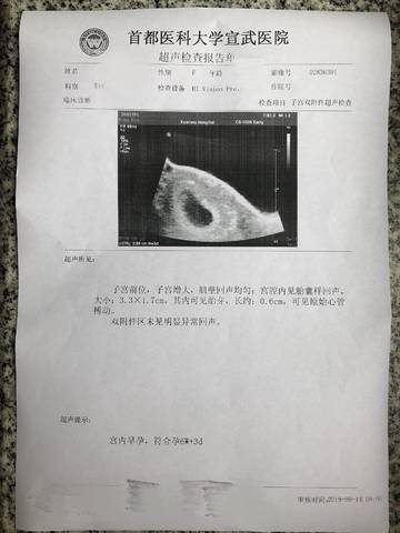 journal_insert_pic_1092932041