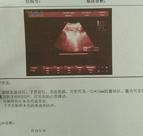 journal_insert_pic_1093430963